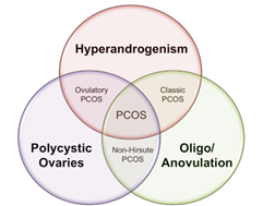 Symptoms and Diagnosis - Rotterdam Criteria of PCOS